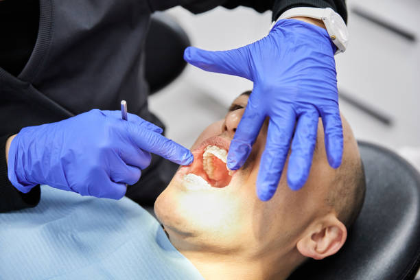 Best Emergency Tooth Extraction in Stony Point, NC